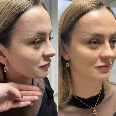 Lips by Nurse mgr piel. Anita Irzik